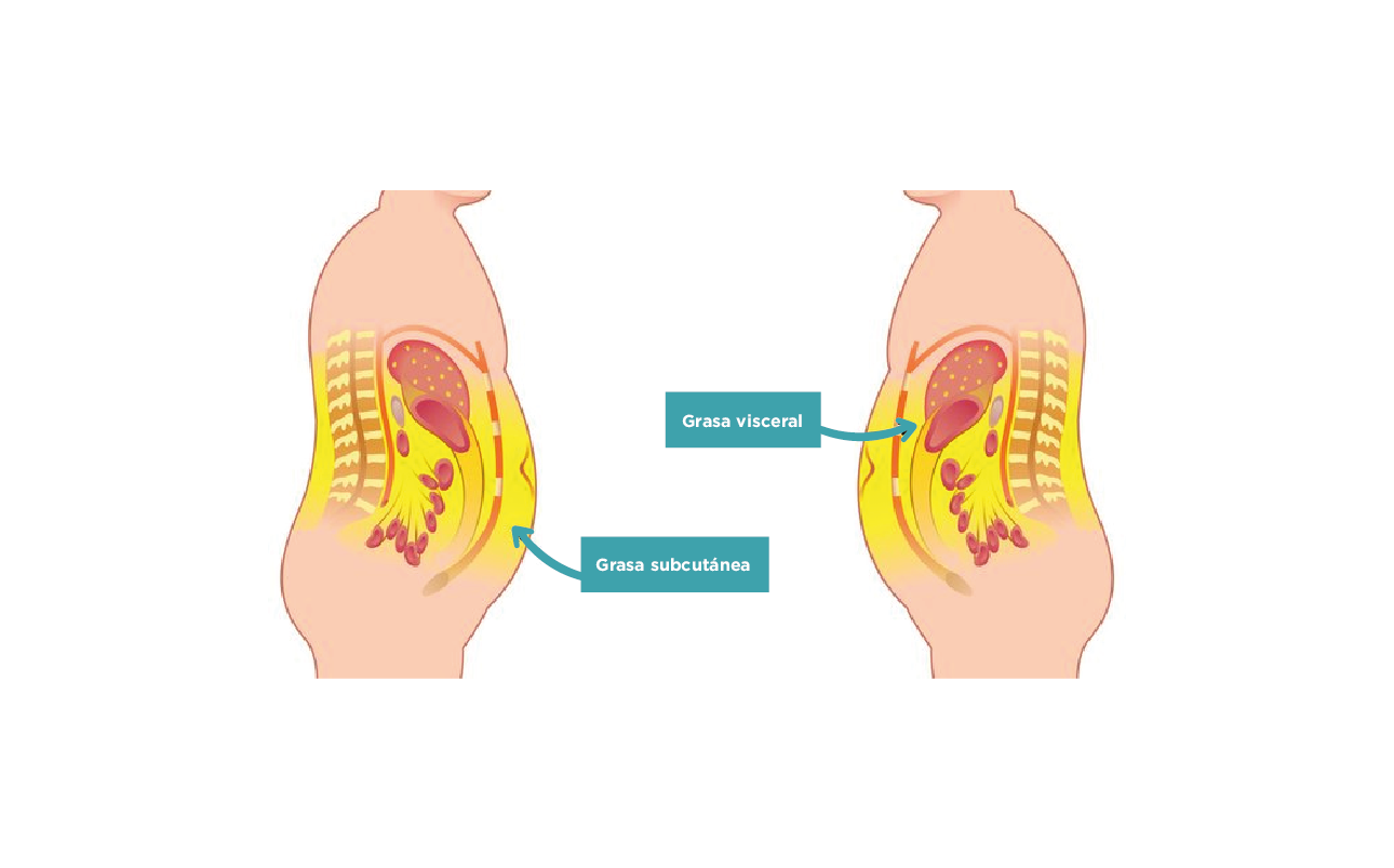 Comparativa entre la grasa visceral y subcutanea de dos cuerpos